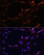SERPINB9 Antibody in Immunocytochemistry (ICC/IF)