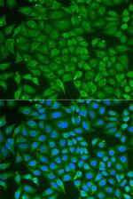 GCDFP-15 Polyclonal Antibody