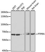 PTPRN Antibody in Western Blot (WB)