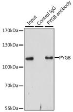 GPBB Antibody in Immunoprecipitation (IP)
