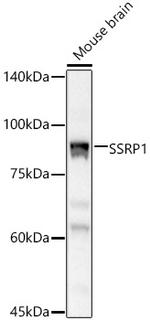 SSRP1 Antibody in Western Blot (WB)