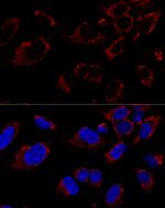 TUFM Polyclonal Antibody