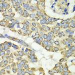 TUFM Antibody in Immunohistochemistry (Paraffin) (IHC (P))
