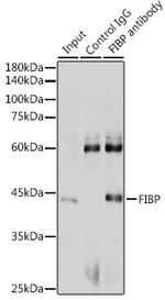 FIBP Antibody in Immunoprecipitation (IP)