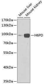 H6PD Polyclonal Antibody