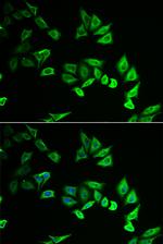 MYOZ2 Polyclonal Antibody