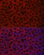 HAO1 Polyclonal Antibody