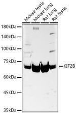 KIF2B Polyclonal Antibody