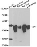 HPD Antibody in Western Blot (WB)