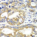 Adenylate Kinase 2 Polyclonal Antibody