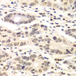 Cyclin C Polyclonal Antibody
