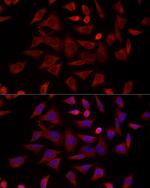 TCP-1 delta Polyclonal Antibody