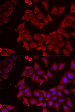 CMPK1 Polyclonal Antibody
