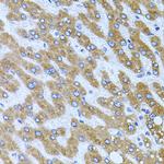Carboxypeptidase M Polyclonal Antibody