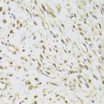 DDX1 Antibody in Immunohistochemistry (Paraffin) (IHC (P))