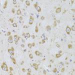 EEF1B2 Antibody in Immunohistochemistry (Paraffin) (IHC (P))
