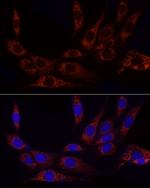 GluD2 Polyclonal Antibody