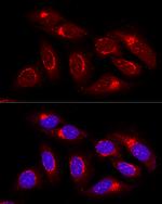 GRASP65 Antibody in Immunocytochemistry (ICC/IF)