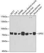 GPD2 Polyclonal Antibody