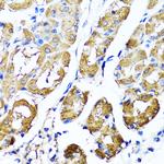 HYAL1 Polyclonal Antibody