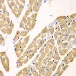 KYNU Polyclonal Antibody