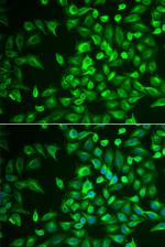 LRAT Antibody in Immunocytochemistry (ICC/IF)