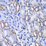 MATK Polyclonal Antibody