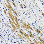 PLA2G2D Antibody in Immunohistochemistry (Paraffin) (IHC (P))