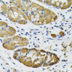 PLA2G2D Antibody in Immunohistochemistry (Paraffin) (IHC (P))