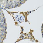 PLA2G2D Antibody in Immunohistochemistry (Paraffin) (IHC (P))