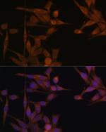 PP2A alpha Antibody in Immunocytochemistry (ICC/IF)