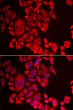QPCT Polyclonal Antibody