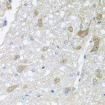 RAPSN Antibody in Immunohistochemistry (Paraffin) (IHC (P))