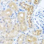 RPS2 Antibody in Immunohistochemistry (Paraffin) (IHC (P))