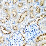 RPS2 Antibody in Immunohistochemistry (Paraffin) (IHC (P))