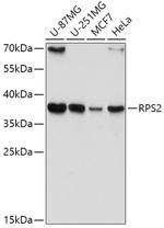 RPS2 Antibody in Western Blot (WB)