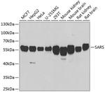 Seryl-tRNA synthetase Antibody in Western Blot (WB)