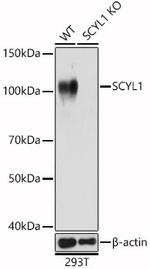 SCYL1 Polyclonal Antibody