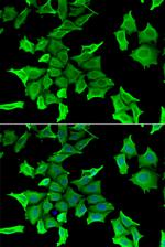 HAI-2 Polyclonal Antibody