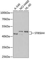 ST8SIA4 Polyclonal Antibody