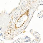 TAGLN Antibody in Immunohistochemistry (Paraffin) (IHC (P))