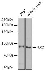 TLK2 Polyclonal Antibody