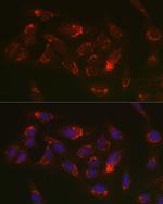 Thioredoxin 2 Antibody in Immunocytochemistry (ICC/IF)