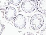 BCL9 Antibody in Immunohistochemistry (Paraffin) (IHC (P))