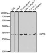 HUS1B Polyclonal Antibody