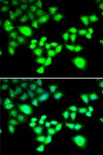 RAD1 Antibody in Immunocytochemistry (ICC/IF)