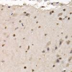 RAD1 Antibody in Immunohistochemistry (Paraffin) (IHC (P))