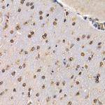 RAD1 Antibody in Immunohistochemistry (Paraffin) (IHC (P))
