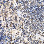 RAD1 Antibody in Immunohistochemistry (Paraffin) (IHC (P))