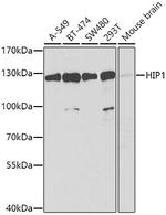 HIP1 Polyclonal Antibody